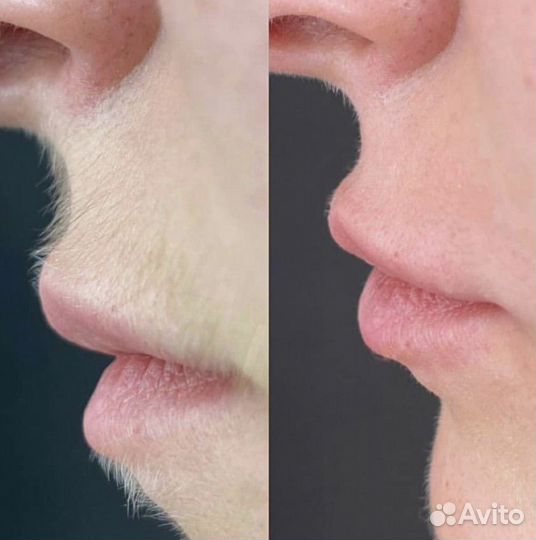 Наращивание ресниц. брови. архитектура бровей