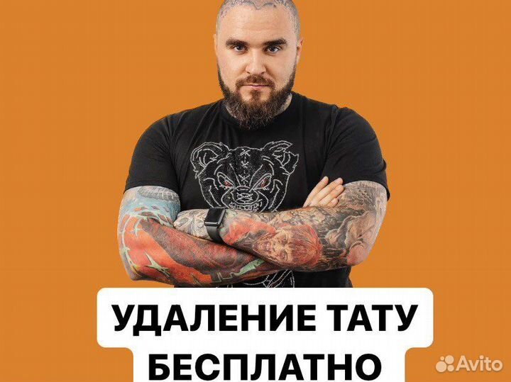 Лазерное удаление татуировок