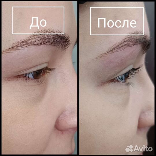 Ламинирование ресниц,оформление бровей,чистка лица