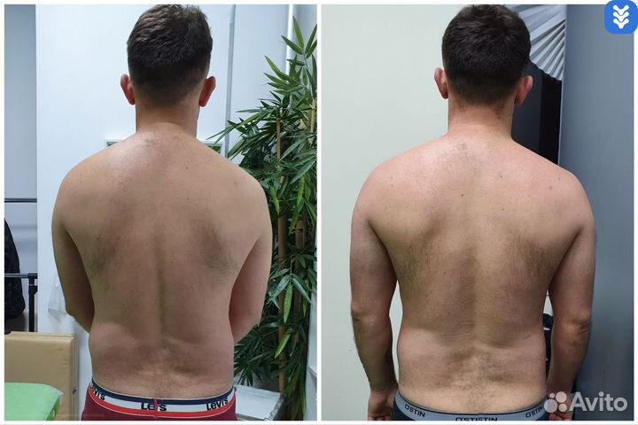 Массаж мануальный остеопат костоправ(м.Киевская)