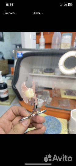 Зубные протезы