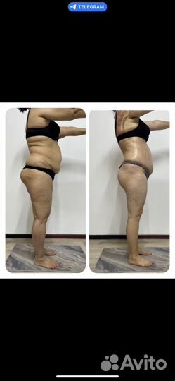 Коррекция фигуры снижение веса