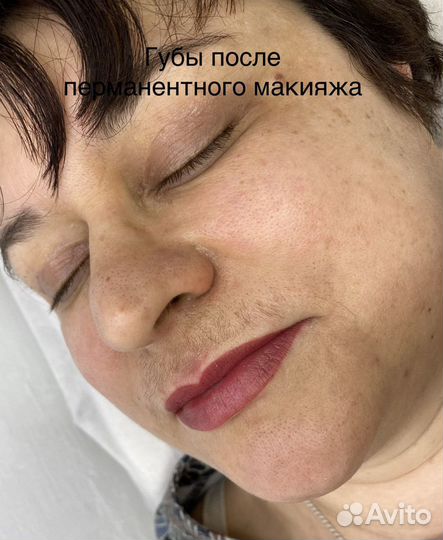 Шугаринг: глубокое бикини