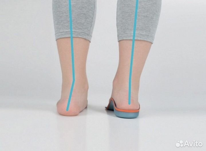 Ортопедические стельки bauerfeind GloboTec Junior