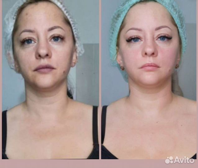 Моделирующий массаж лица и тела