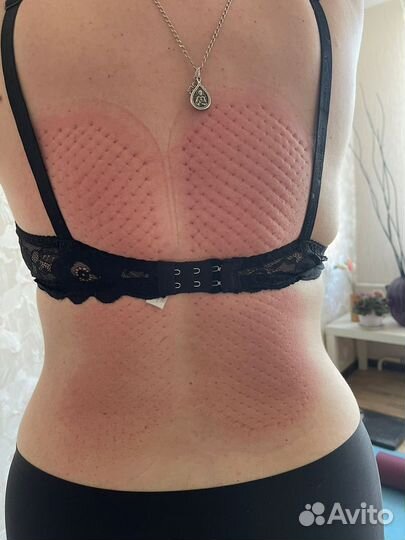 Гвоздестояние, гвоздетерапия