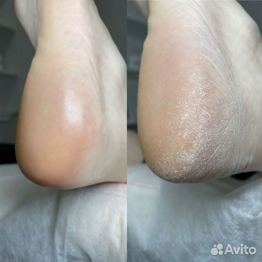 Педикюр Smart