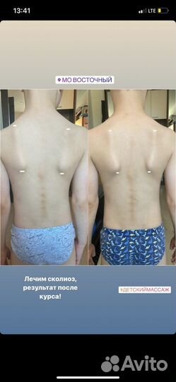 Детский массажист с выездом на дом