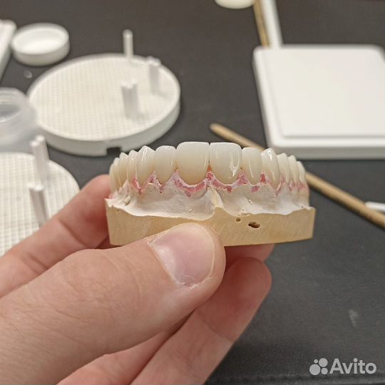 Зубной техник.Cad/cam.Зубные протезы