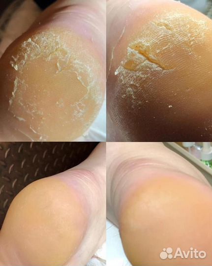 Маникюр и педикюр