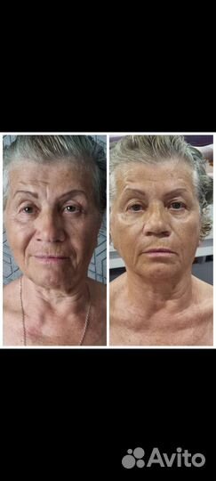 Массаж лица