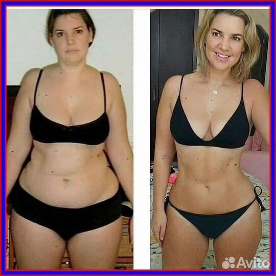 Массаж LPG (оригинальный аппарат keymodule )