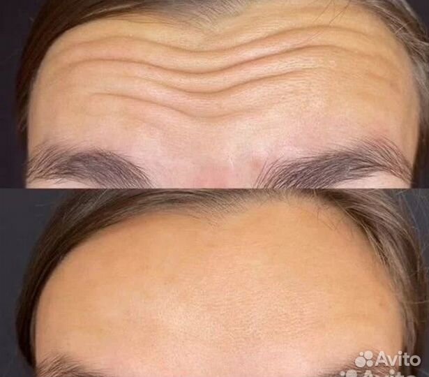 Врач косметолог - дерматолог. Стаж 15 лет