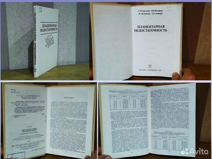 Плацентарная недостаточность Г.М. Савельева