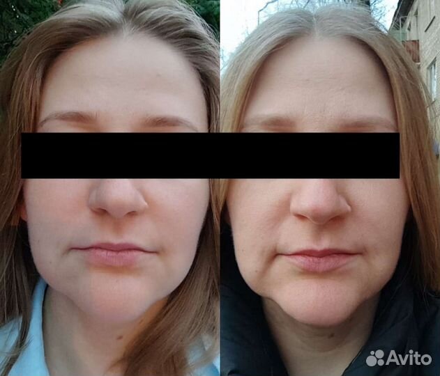 Массаж лица/Чистка лица/Пилинги