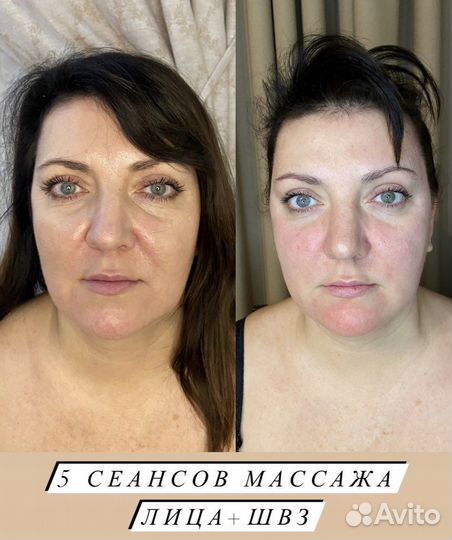 Миофасциальный массаж лица и головы