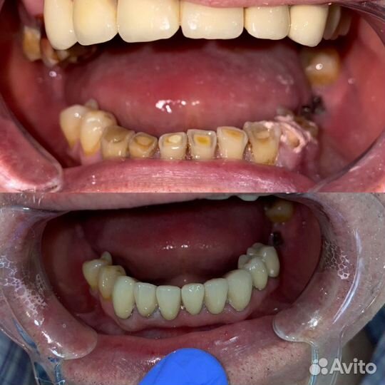 Стоматолог универсал, стоматолог хирург