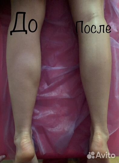 Лимфодренажный, антицеллюлитный массаж, классика