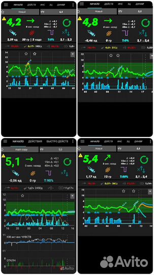 Инсулиновая помпа - настройка androidaps