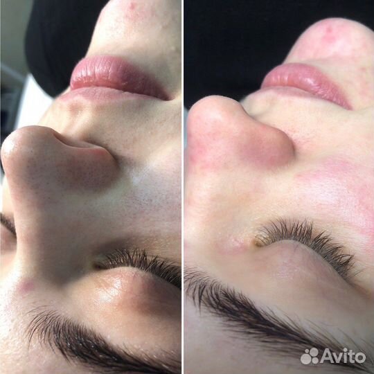 Услуги косметолога