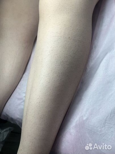 Модель на процедуру шугаринг