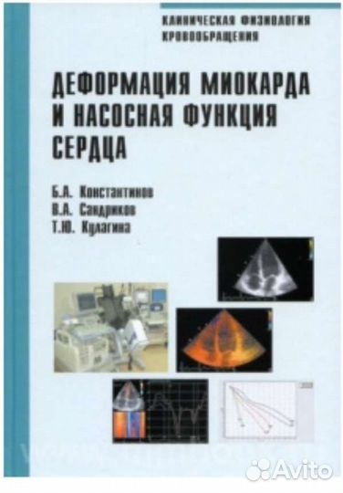 Деформация миокарда Константинов