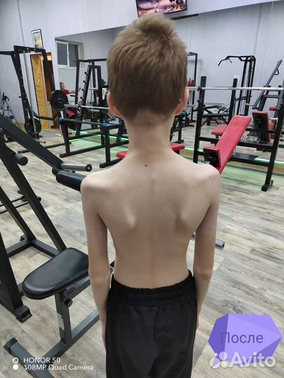 Массаж Оздоровительный - Костоправие