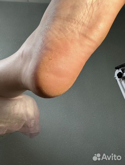 Смарт педикюр