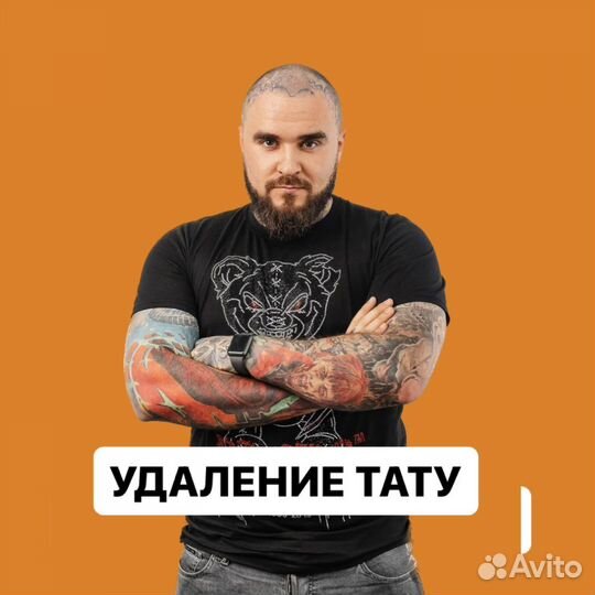 Удаление тату