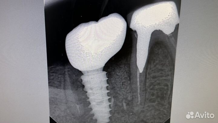 Врач стоматолог ортопед имплантолог