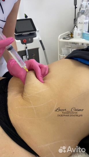 Липолитики тело