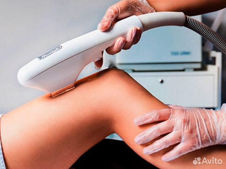 Продается готовый бизнес лазерной эпиляции