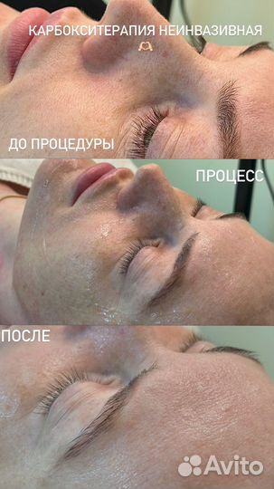 Услуги косметолога
