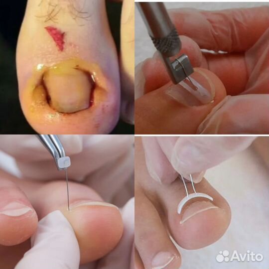 Подология,педикюр, маникюр