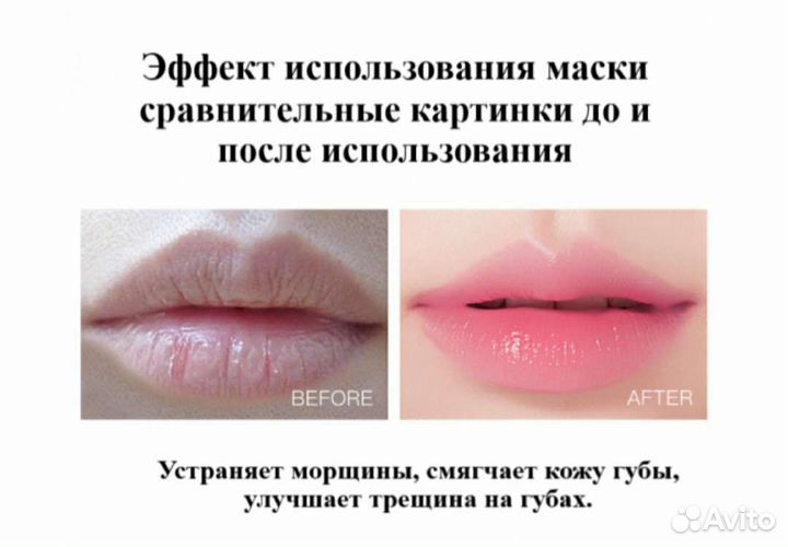 Увлажняющие гидрогелевые патчи для губ