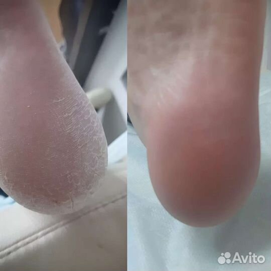 Мужской Женский Детский Маникюр Педикюр Киров