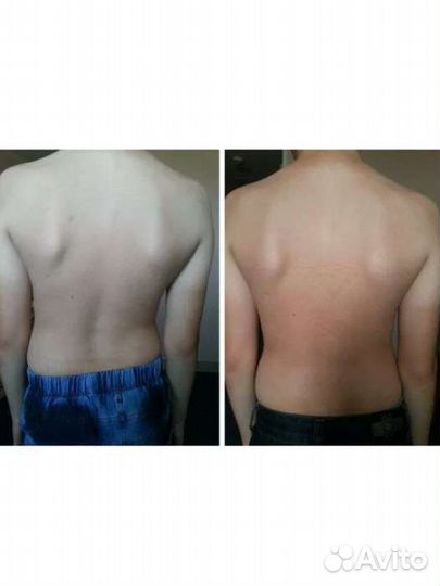 Массаж костоправ