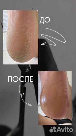 Маникюр,smart педикюр