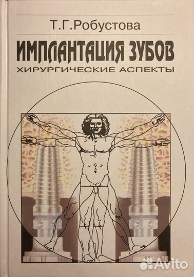 Имплантация зубов