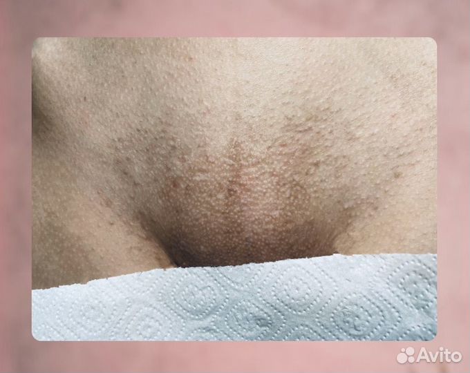 Восковая депиляция