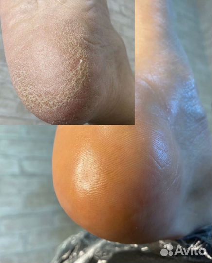 Маникюр педикюр