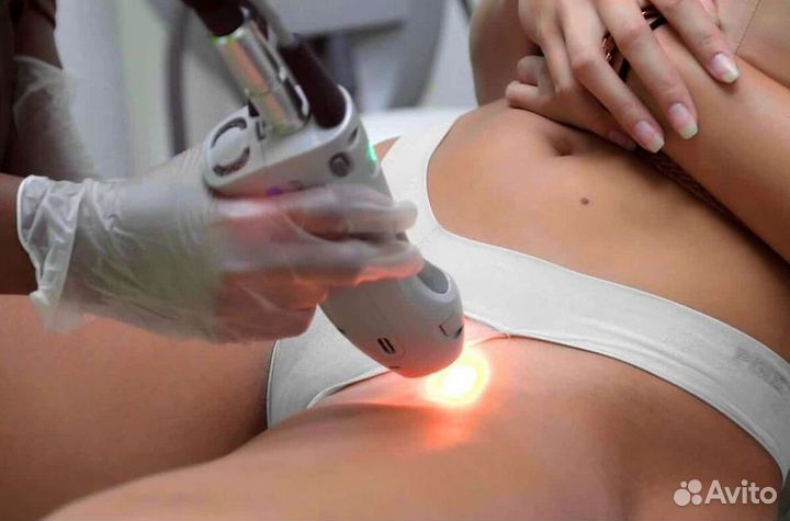 Лазерная эпиляция — готовый бизнес для вас