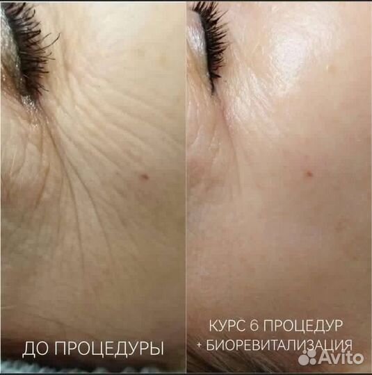 Услуги косметолога