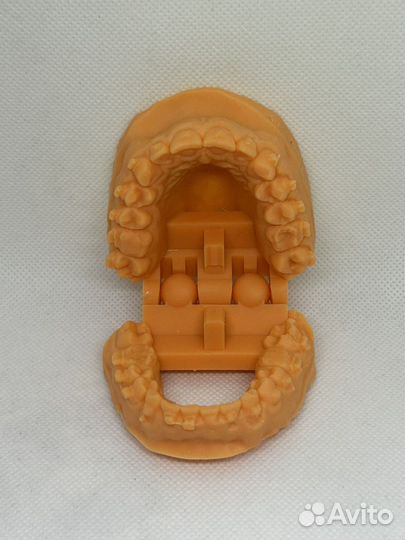 Ортодонтическая 3-D печать