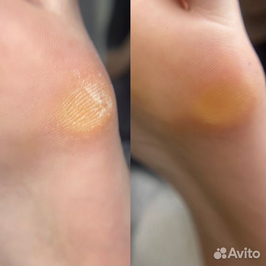 Модель на педикюр