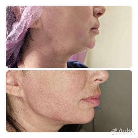 Косметолог.Лицо под ключ (Luxe Face)