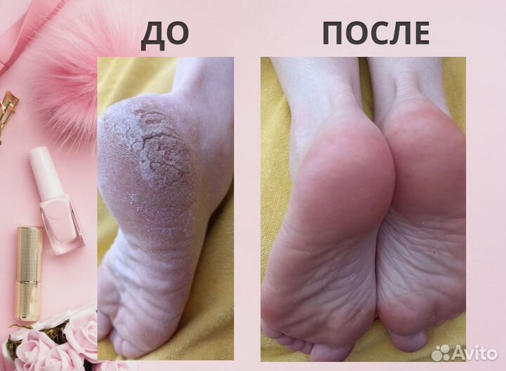 Модель на маникюр педикюр