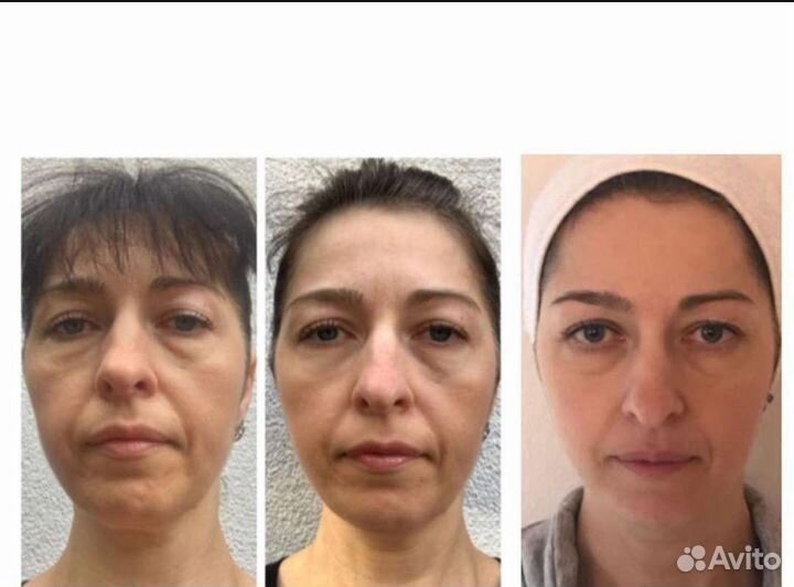 Фейсфитнес/Массаж лица/Фейслифтинг/Тренер/Пилатес