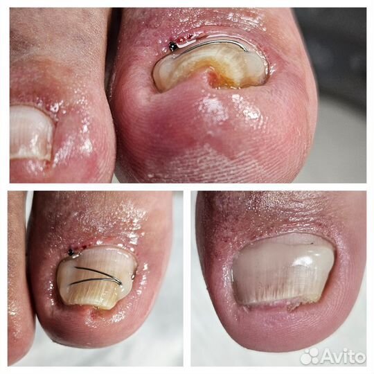 Подолог/ индивидуальные стельки