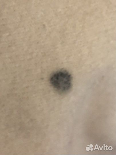 Бандаж после кесарева